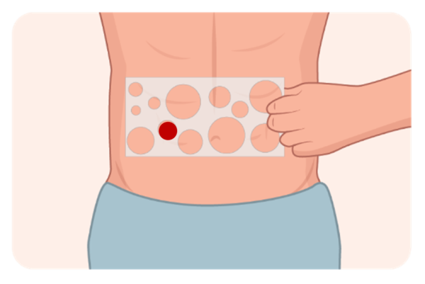 Training Stomagienics Educational Videos To Use Stomagienics Products