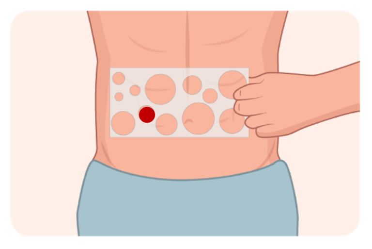 Training Stomagienics educational videos to use Stomagienics products